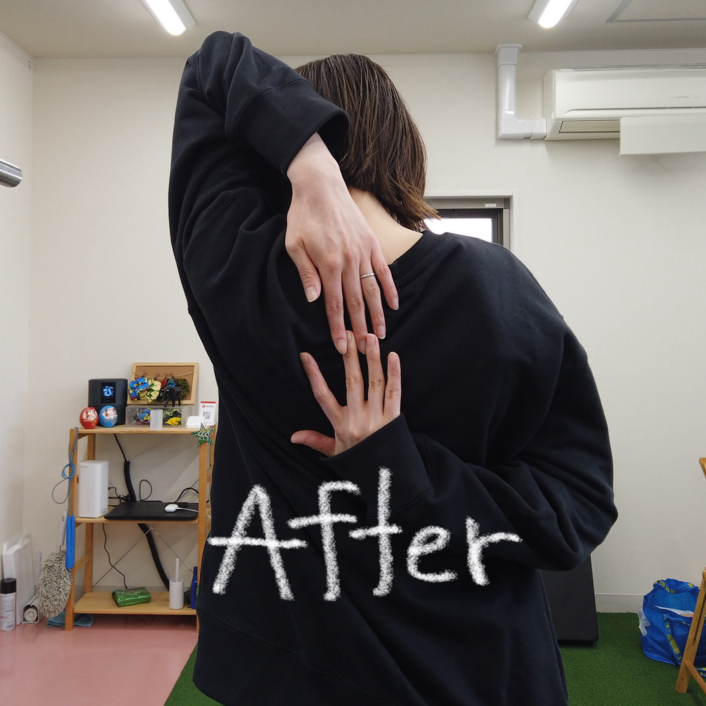 施術後：肩甲骨まわりの可動域が広がった状態