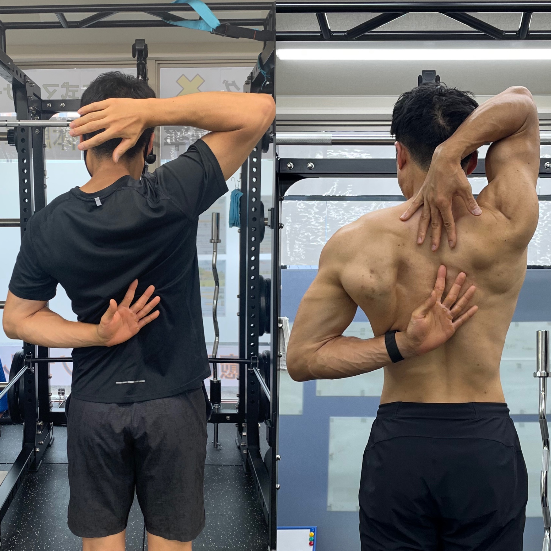 施術前後の肩甲骨可動域の比較。左がBefore、右がAfter。